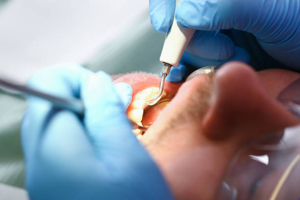 Best Emergency Dental Surgery in Glassmanor, MD