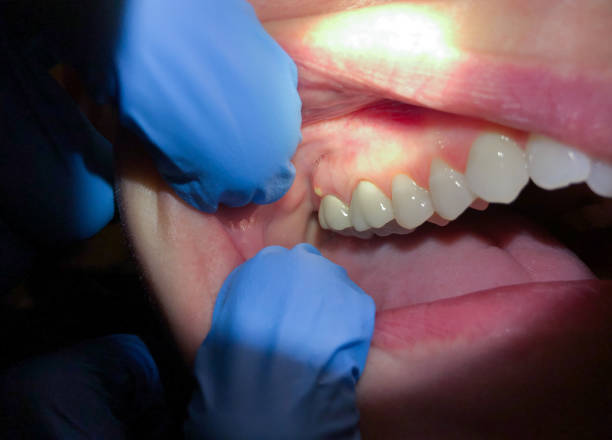Best Urgent Dental Care in Glassmanor, MD